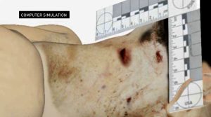 Ellen R Greenberg Autopsy Computer Model Neck Anatomy with Knives