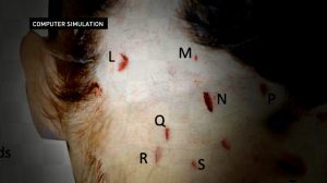 Ellen R Greenberg Autopsy Computer Model Neck Anatomy with Knives