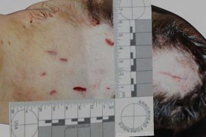 Ellen R Greenberg Autopsy Computer Model Neck